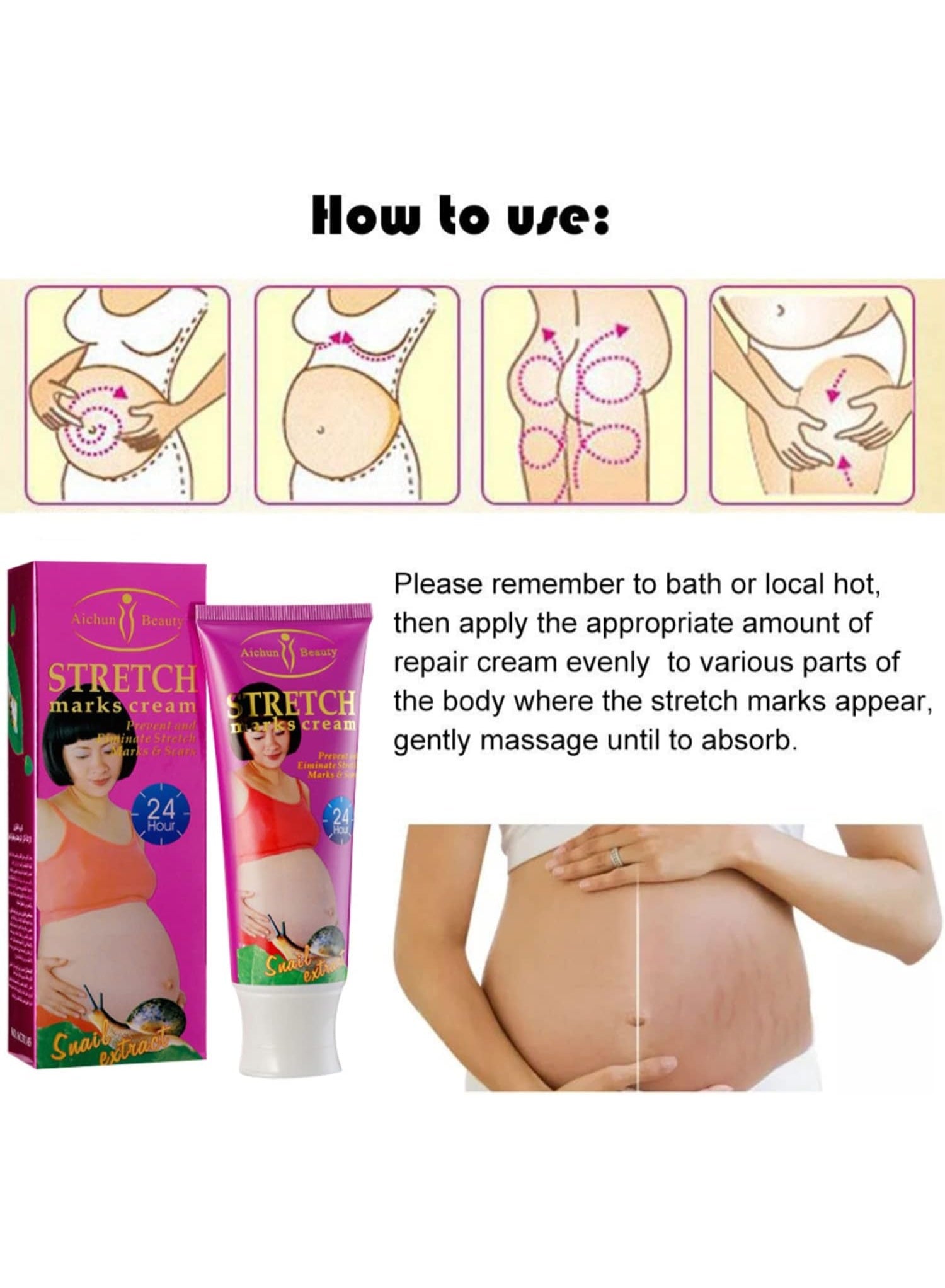 aichun beauty, cells 120g, cream snail, damaged skin, extract reduce, marks cream, marks cream snail, reduce skin, remove damaged, scars remove, skin cells, skin cells 120g, skin scars, snail extract, stretch marks
