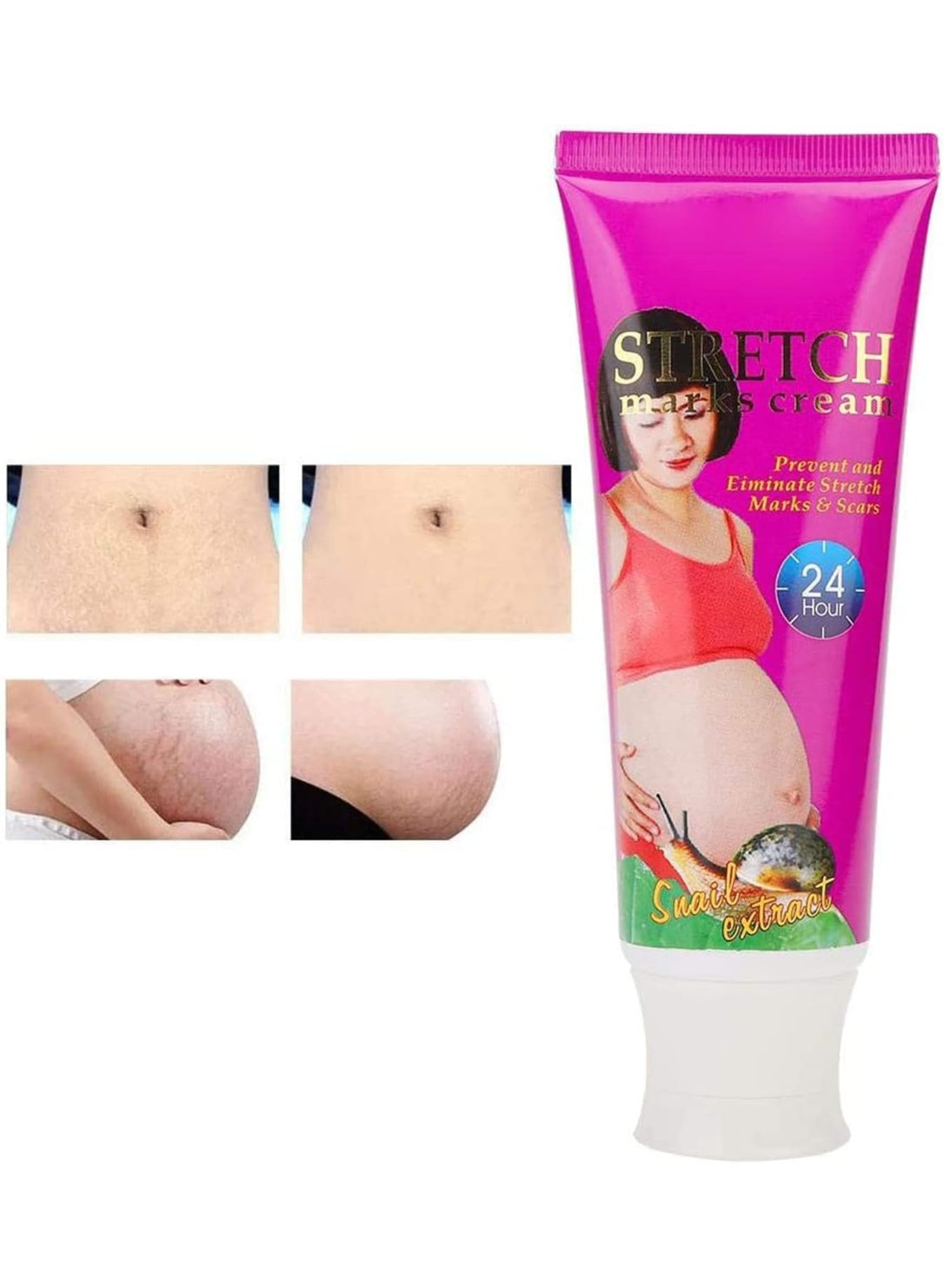 aichun beauty, cells 120g, cream snail, damaged skin, extract reduce, marks cream, marks cream snail, reduce skin, remove damaged, scars remove, skin cells, skin cells 120g, skin scars, snail extract, stretch marks