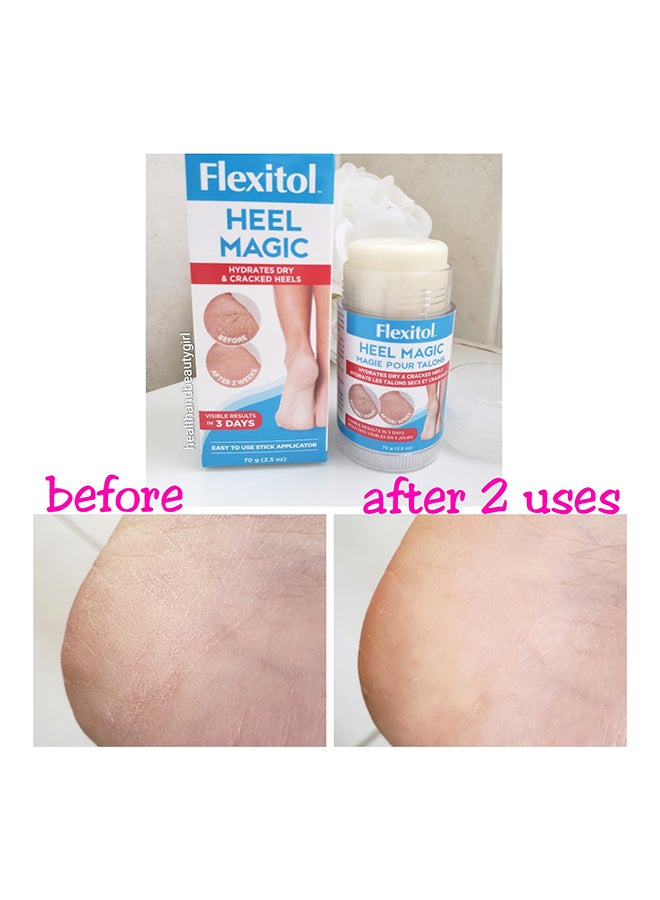 Flexitol Heel Magic 70grams - Premium Foot Care