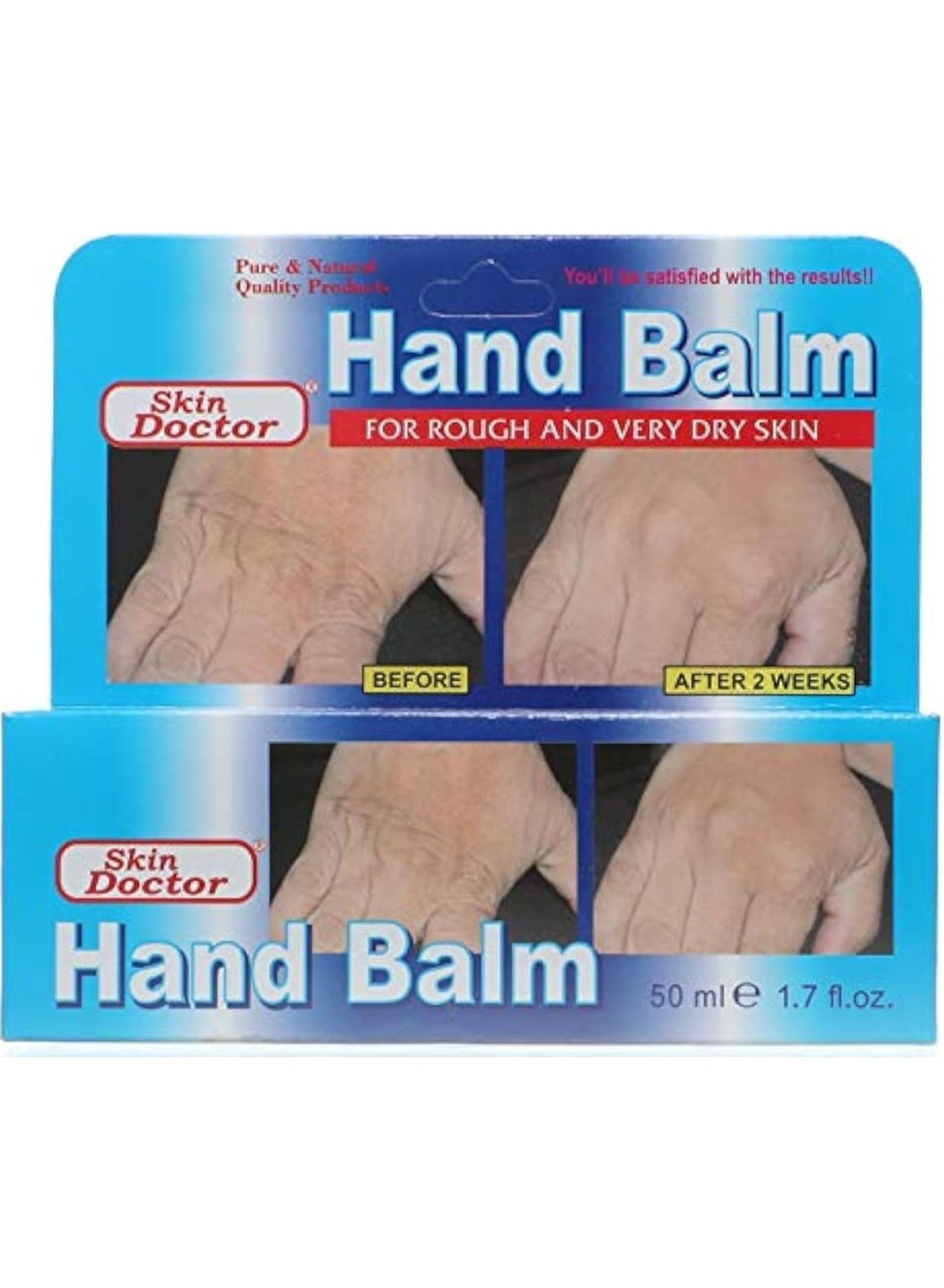 almond oil, balm moisturizers, balm moisturizers cream, dry rough, hand balm, hand balm moisturizers, hand care, keep hands, like shea, longer key, moisturizers cream, name hand, rich cream, skin doctor, skin type