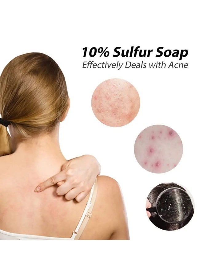 80grams, Bath & Body - Soap, Skin Doctor