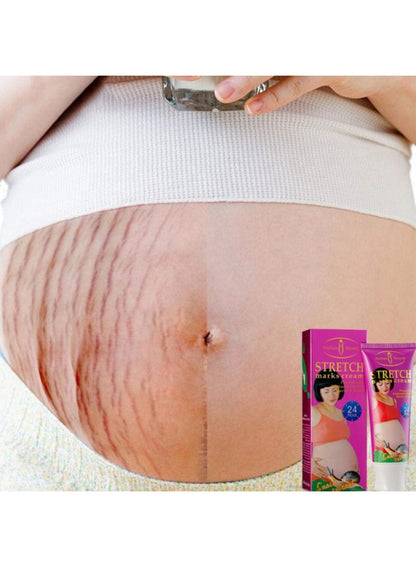 aichun beauty, cells 120g, cream snail, damaged skin, extract reduce, marks cream, marks cream snail, reduce skin, remove damaged, scars remove, skin cells, skin cells 120g, skin scars, snail extract, stretch marks