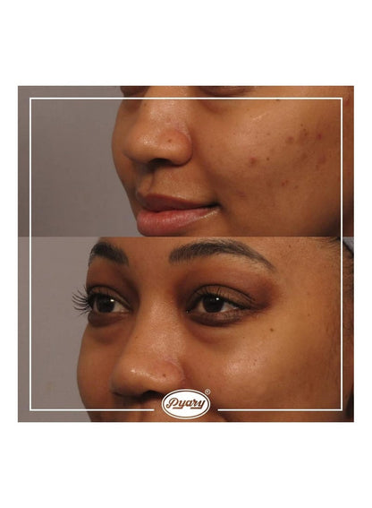 Pyary Papaya Cream for Skin Whitening 80g