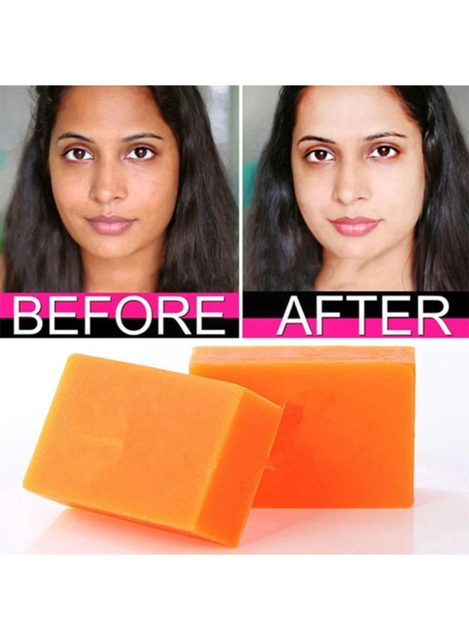 3pcs x100g, acid soap, acid soap trio, body brightening, dark spots, dark spots pimples, guanjing beauty, kojic acid, kojic acid soap, skin whitening, skin whitening dark, soap trio, spots pimples, whitening dark, whitening dark spots